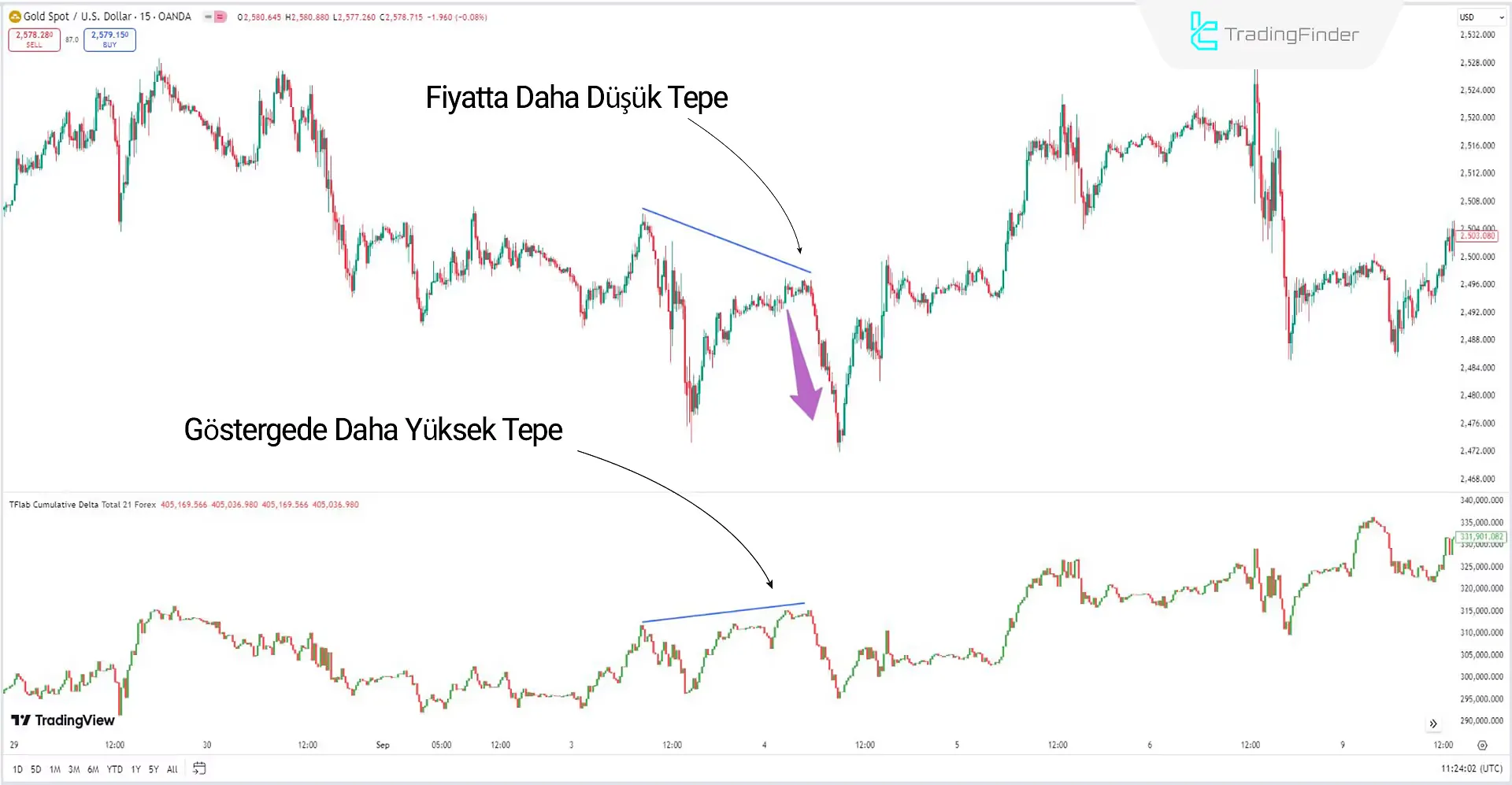 CVD Düşüş Trendi