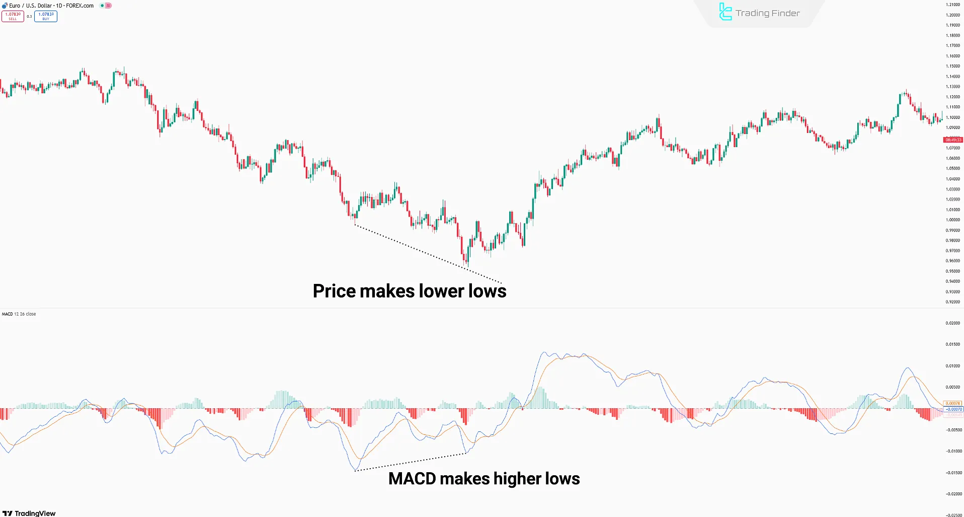 MACD Divergence Trading Stratejisi